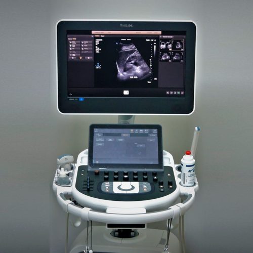 Ultrassom Bestane